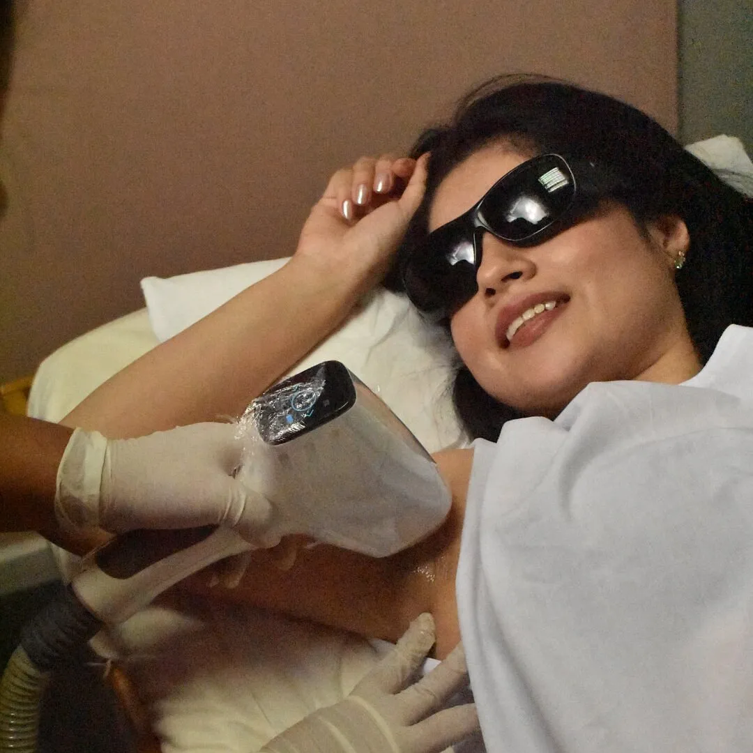 Clienta sonriente con lentes de protección durante una sesión de depilación láser