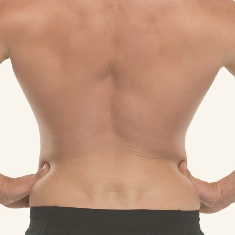 Depilación láser de lumbar para hombre
