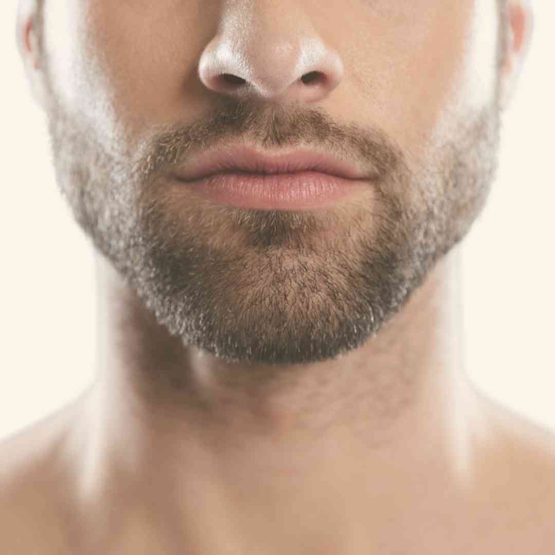 depilacion-laser-delineado-de-barba-hombre Delineado de Barba - Imagen 1
