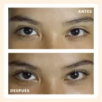 radiance_lifting_antes_despues_1