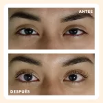 radiance_lifting_antes_despues_2