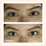 radiance_lifting_antes_despues_3