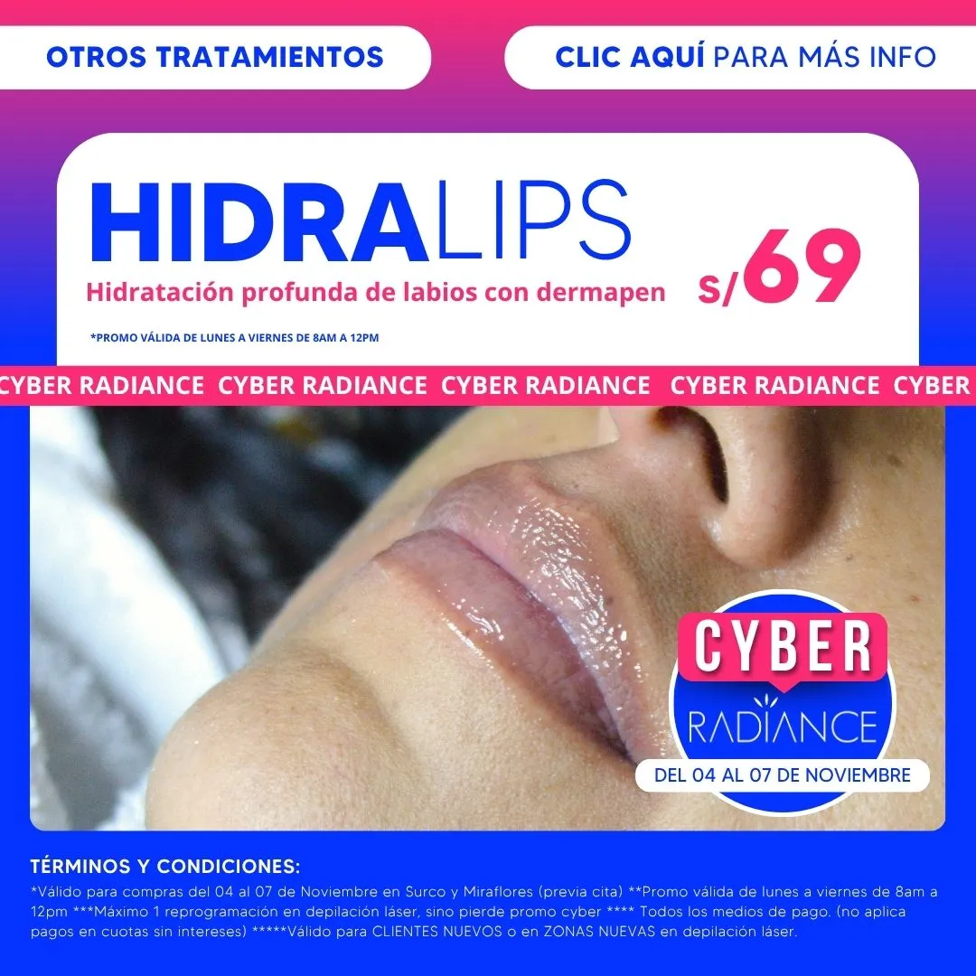 radiance_promo_cyber_wow_hidralips