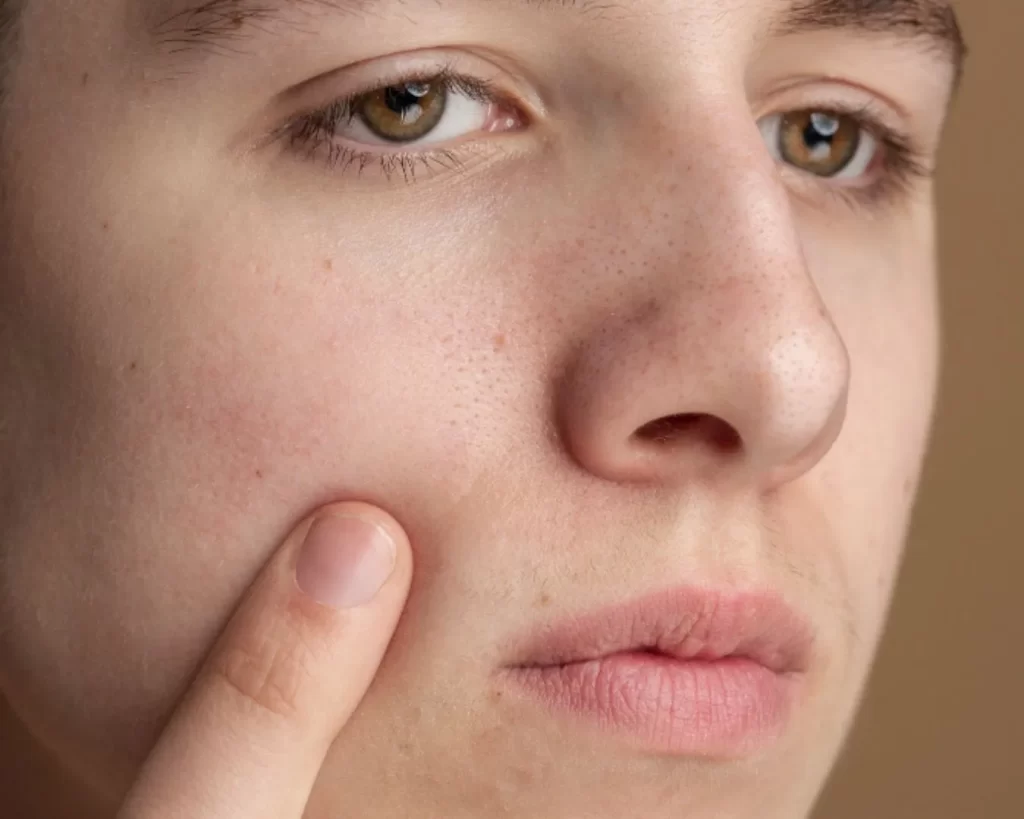 radiance_blog_portada_7_señales_de_que_necesitas_una_limpieza_facial_profunda