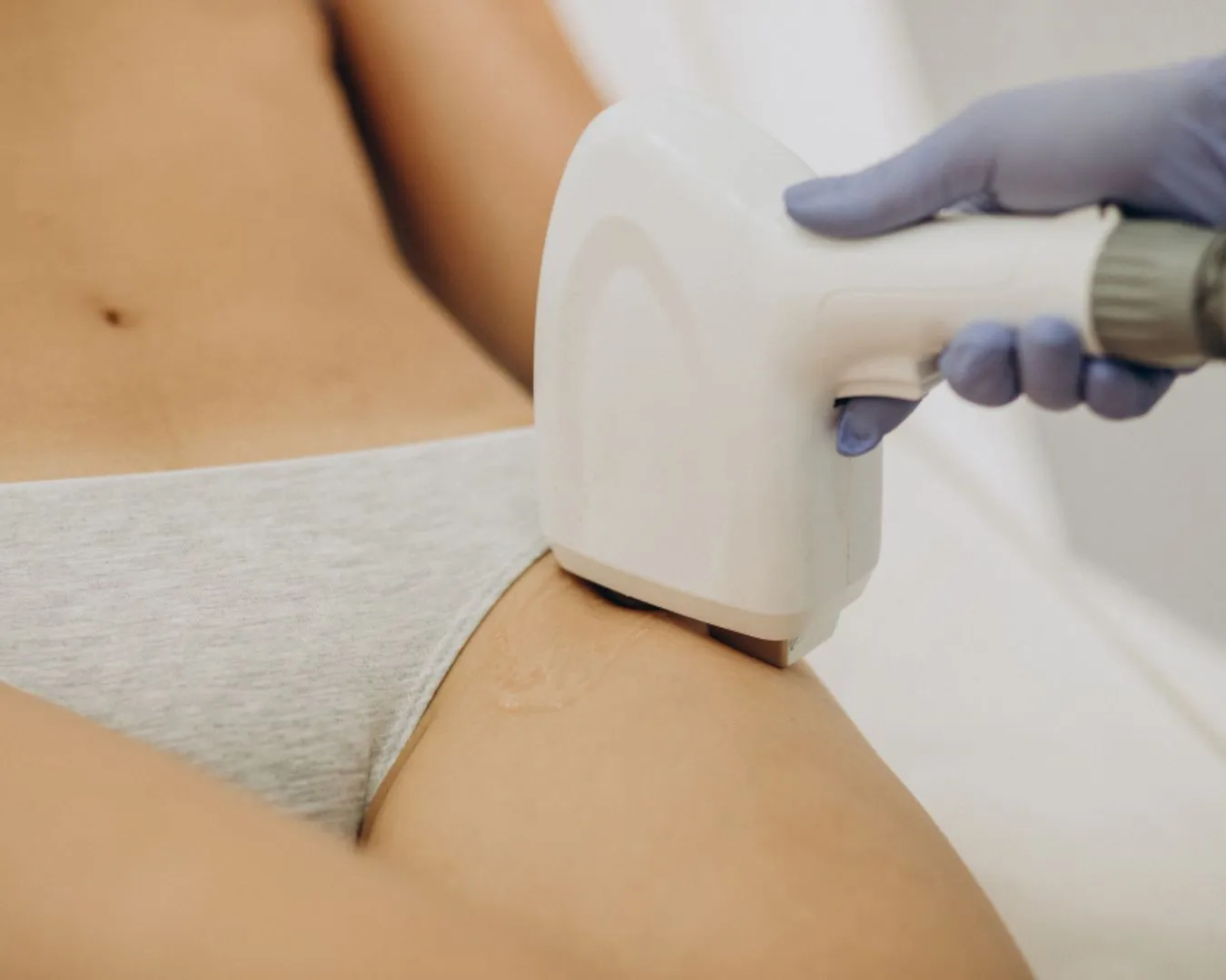 radiance_blog_portada_premiere_seance_depilation_laser_maillot_bresilien