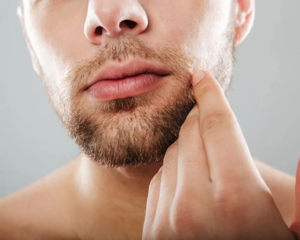 radiance_blog_portada_todo_lo_que_debes_saber_sobre_el_vello_facial_masculino